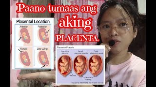 Paano tumaas ang placenta or inunan  Placenta previa totalis to Anterior placenta  Causes symptoms [upl. by Giustina546]