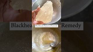 1 Day BlackheadsWhiteheads Removal Glass Shine Nose blackheads skincare beauty [upl. by Auliffe]