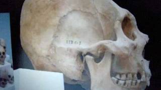 ELONGATED SKULLS AND THE NEPHILIM0001wmv [upl. by Garibald]