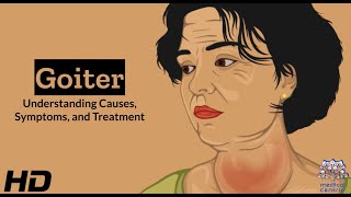 Thyroid Troubles Navigating Goiter  Causes Symptoms and Treatment Explained [upl. by Rochus]