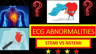 ECG abnormalities  STEMI and NSTEMI [upl. by Nylrahc]