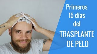 TRASPLANTE DE PELO  ¿QUÉ HACER LOS PRIMEROS DÍAS ¿QUÉ PUEDES SUFRIR [upl. by Lainad]