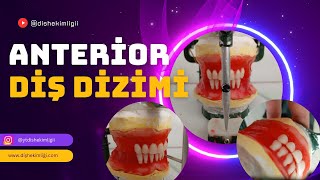 Anterior Diş Dizimi [upl. by Eyar]