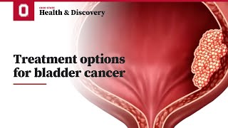 Treatment options for bladder cancer  Ohio State Medical Center [upl. by Melisenda202]