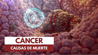 ¿Cómo muere la gente de cáncer [upl. by Rimola]