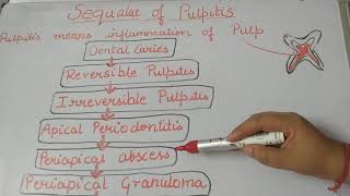 Pulpitissequalaeofpulpitislecture1dentalnotes [upl. by Bornstein224]