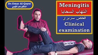 meningitis quotclinical examinationquot I الفحص السريري لالتهاب السحايا [upl. by Innor]