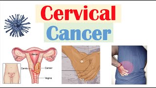 Cervical Cancer Risk Factors Pathophysiology Symptoms Staging Diagnosis Treatment amp Prevention [upl. by Aiak]