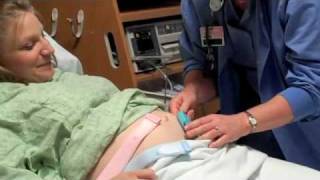 Maternity Fetal Monitoring [upl. by Doner]