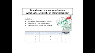 Bestrahlung vom supraklavikulären Lymphabflussgebiet beim MC  Strahlentherapie Prof Hilke Vorwerk [upl. by Olegnad152]