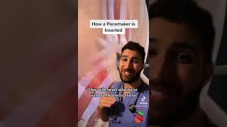 How a Pacemaker is Inserted heartblock [upl. by Noffets932]