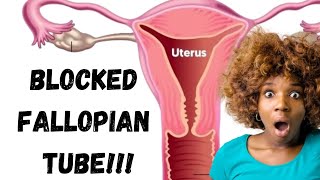 SIMPLE TIPS TO GET PREGNANT WITH BLOCKED TUBES [upl. by Gonta]