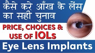 Price Choice amp Benefits of IOL Lenses  Lens for Cataract Surgery कैसे करे आँख के लेंस का सही चुनाव [upl. by Scoles132]