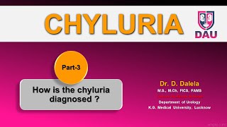 CHYLURIA How is it diagnosed [upl. by Foulk]