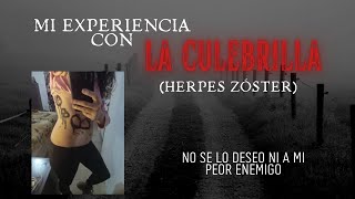 Mi HORRIBLE experiencia con la CULEBRILLA herpes zóster  ¡Me dolía hasta el roce de la remera [upl. by Tillfourd]