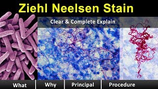 ziehl neelsen Stain  Clear amp Complete Overview [upl. by Hcurab]