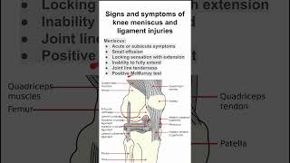 Signs and symptoms of knee meniscus and ligament injuries [upl. by Baumann]