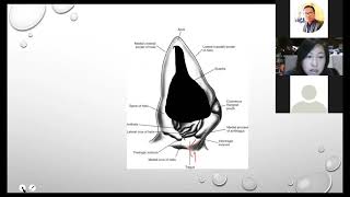 Haematoma in dogs [upl. by Sewel]