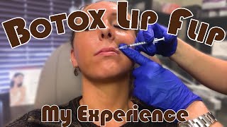 Getting a Botox Lip Flip  My Honest Experience  Before amp After  Botox Injection Footage [upl. by Amlev]