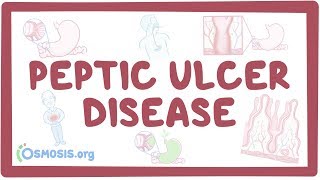 Peptic ulcer disease  causes symptoms diagnosis treatment pathology [upl. by Caraviello306]