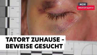 Gewalt gegen Frauen – gerichtsfeste Spurensicherung im Krankenhaus ohne Polizei [upl. by Sandra]