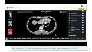 ¿Usted puede analizar una tomografía sin ser radiólogo radiology tomografia medicina [upl. by Noevart]