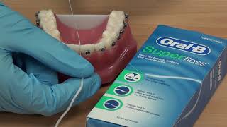 How to use Superfloss with fixed braces [upl. by Hepsiba420]