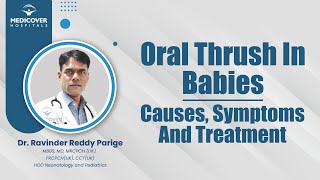 Oral Thrush In Babies Causes Symptoms And Treatment  Medicover Hospitals [upl. by Blight]