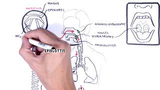 Stridor in children causes inspiratory and expiratory stridor pathophysiology [upl. by Donal]