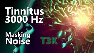 Tinnitus T3K 3000 Hz Noise Masking Might Relieve Your Ringing [upl. by Wystand751]