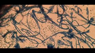 Food fungus under the Microscope [upl. by Kalvin]