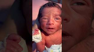 Low Birth weight 1240gmmedical baby trendingshorts viralvideo [upl. by Yanrahs]