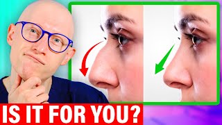 Nose Job Explained by a Surgeon [upl. by Rufe733]