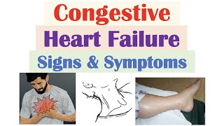 Congestive Heart Failure Signs amp Symptoms amp Why They Occur [upl. by Ihcas]