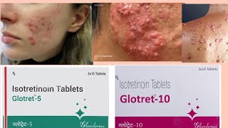 Glotret tablets 5102030mg treatment in nodulocystic acne oily skinacne pimples treatment [upl. by Noirb]