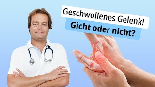 Geschwollenes Gelenk Gicht oder nicht [upl. by Surad790]