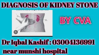 Diagnosis of kidney stones۔۔۔by Costovertebral angle tenderness۔ [upl. by Lyndell]