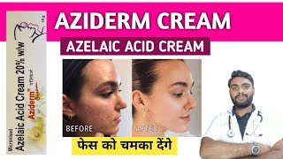 Azelaic acid cream  How to use azelaic acid cream  Best azelaic acid cream  Aziderm cream [upl. by Schaeffer]