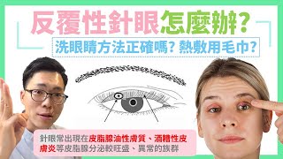 針眼反覆發作怎麼辦？第一次長針眼除了吃抗生素，熱敷只能用毛巾嗎？ 清洗眼睛不可缺少的法寶，擺脫反覆性針眼 [upl. by Aicenaj803]