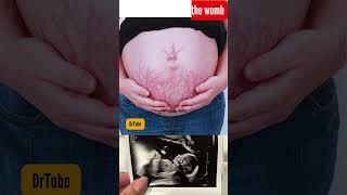 baby in 36 week in mother womb  baby in the womb 37 weeks development baby belly pregnancy [upl. by Tillfourd]