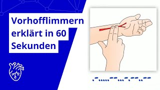 Was ist eigentlich Vorhofflimmern In einer Minute erklärt [upl. by Euqinommod]