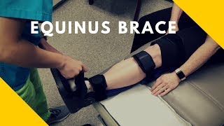 Equinus Brace [upl. by Payton]