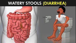 Diarrhea Symptoms Causes And Treatments of Diarrhea [upl. by Emoreg350]