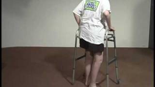 Abnormal Gait Exam  Neuropathic Gait [upl. by Deloris167]