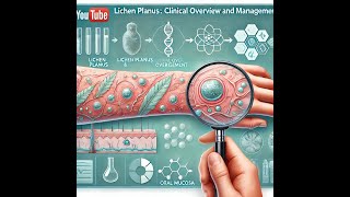 Lichen Planus Clinical Overview and Management [upl. by Subocaj]