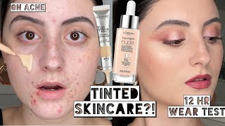 Best Makeup Day LOREAL TINTED HYALURONIC SERUM amp EYECREAM ON ACNE  10 Hour Wear Test [upl. by How384]