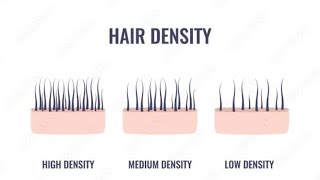 hair density test [upl. by Judus]