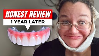 The Hidden Downsides of Dental Implants I Wish I Knew 1 Year Later [upl. by Nalloh832]