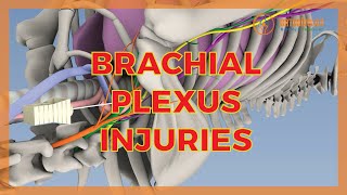 BRACHIAL PLEXUS INJURIES [upl. by Nalyt]