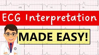 How to interpret an ECG systematically  EXPLAINED CLEARLY [upl. by Eelek995]